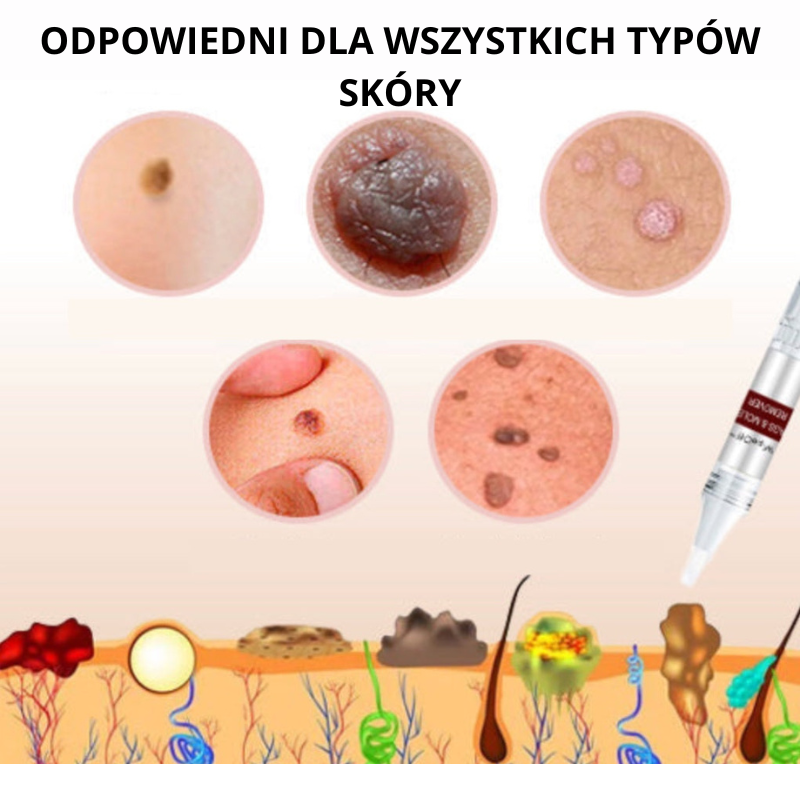 WipeOff Pro™ - maść do usuwania znamion i pieprzyków