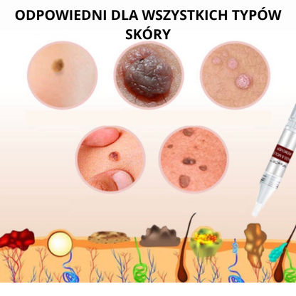 WipeOff Pro™ - maść do usuwania znamion i pieprzyków