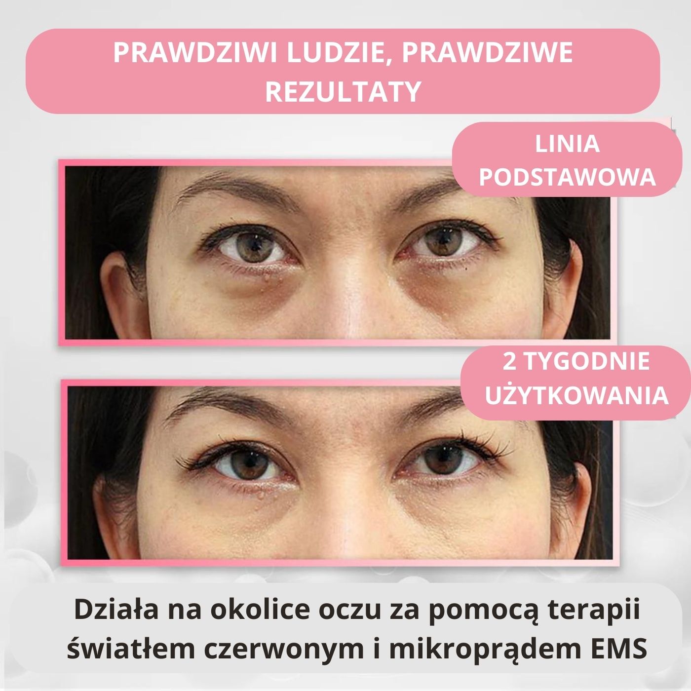 RevitalEyes - terapia światłem czerwonym pod oczy